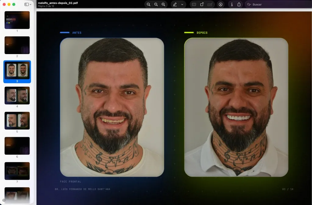 Tela do Zmile Pitch: apresentação de caso com antes e depois do paciente e o book de páginas na lateral